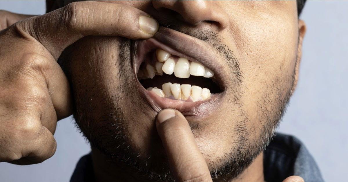 rticle.jpg672107a8866d7 - تفسير حلم سقوط الاسنان وظهور اسنان جديده