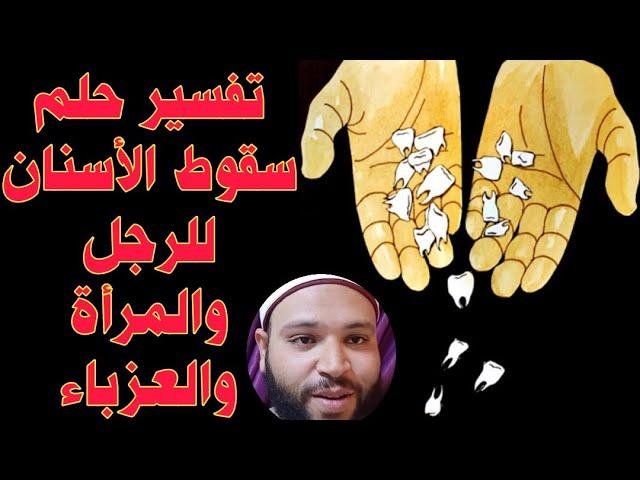 efault.jpg6733e75db5b2b - تفسير حلم سقوط بعض الاسنان