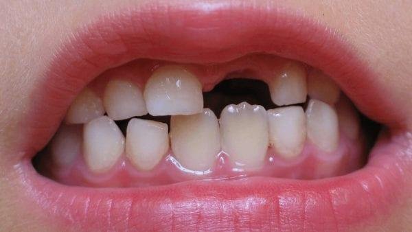 lt 4 1.jpg673013e5b8cc7 - تفسير حلم سقوط الاسنان السفلية للمتزوجة